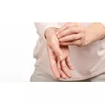 Czy łuszczyca jest zaraźliwa?