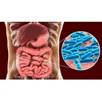 Zioła na pasożyty w organizmie