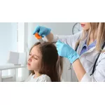 Domowe sposoby na wszawicę - jakie naturalne środki warto stosować?