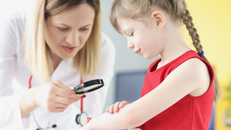 Łuszczyca u dzieci i niemowląt | iZielnik.pl